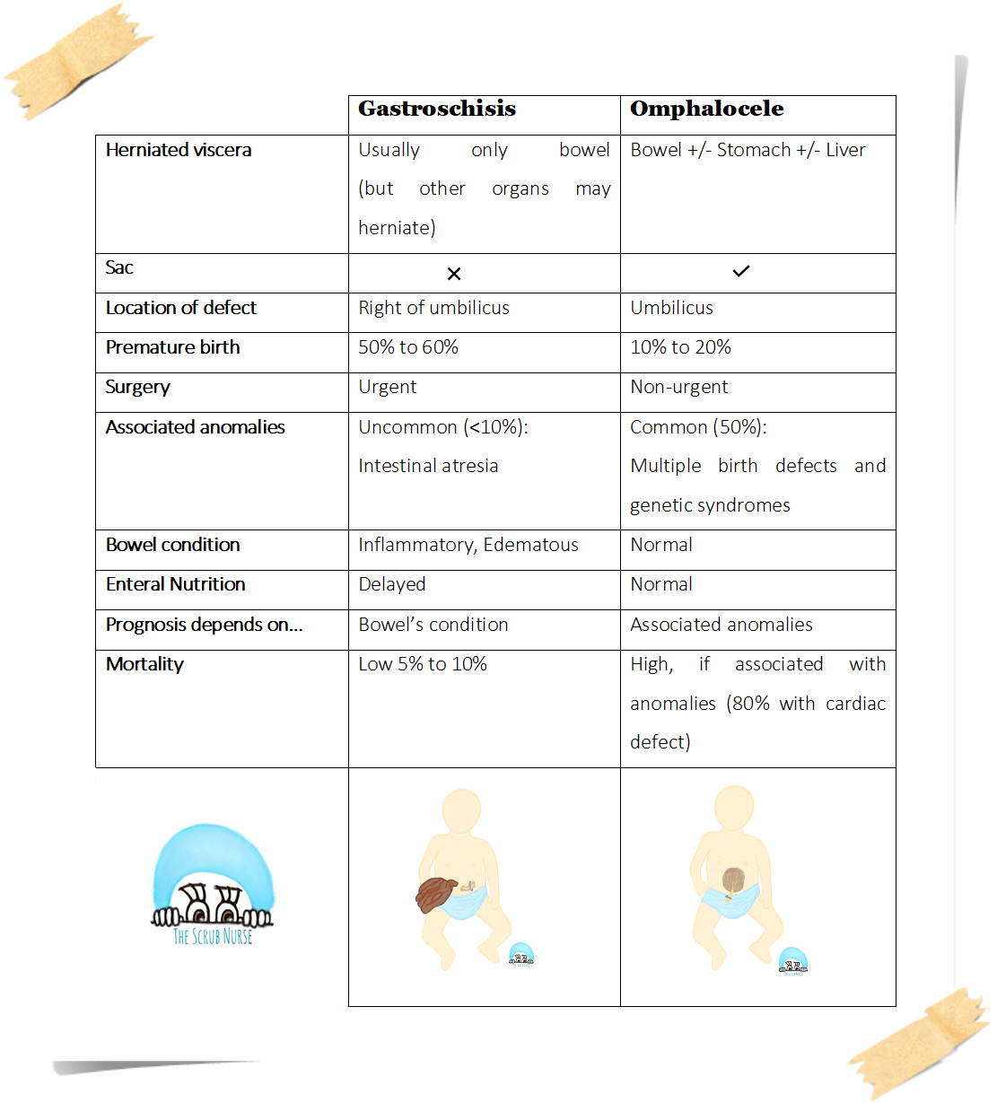 Gastroschisis vs Omphalocele (Exomphalos) The Scrub Nurse