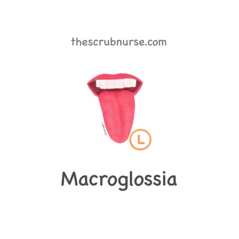 rsz_macroglossia-solution